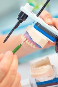 Herstellung Ihres Zahnersatzes